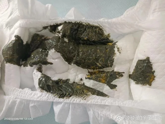 梦见小孩拉稀粘一手_1