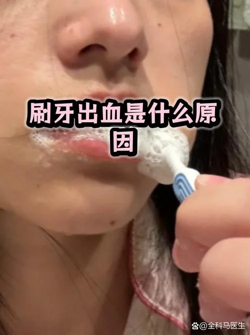 梦见刷牙出血 心理学_1