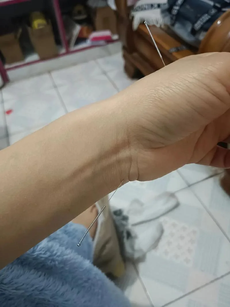 梦见很多医用针头扎我_1