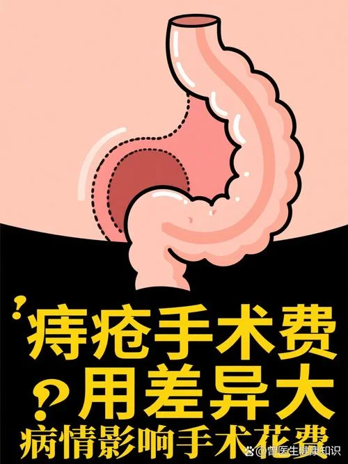 微创痔疮 多少钱_1