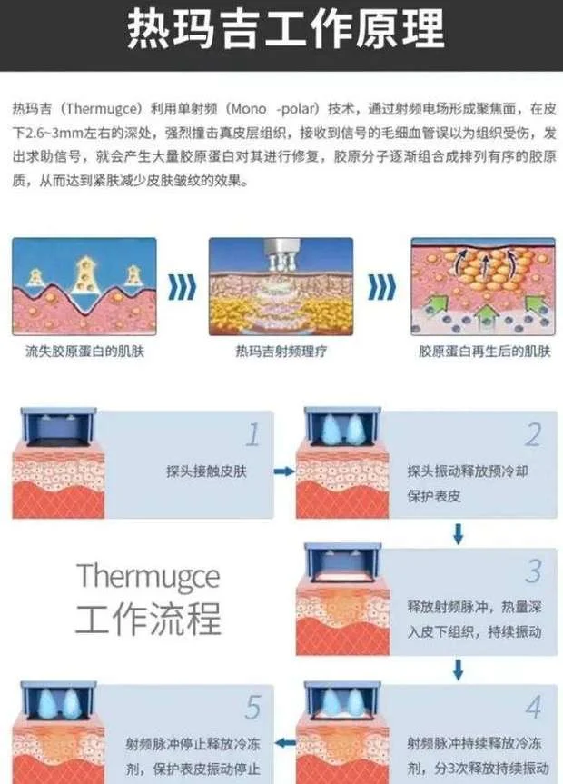 腹部热玛吉多少钱_2