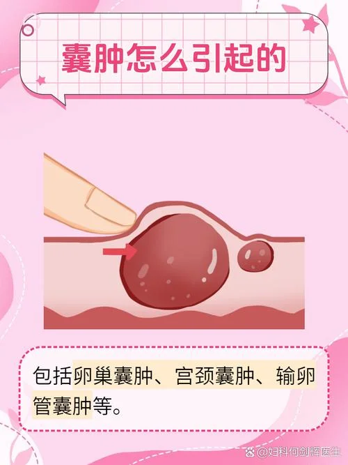 什么是纳囊_2