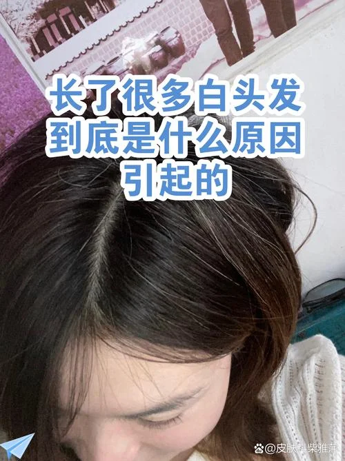 梦见长白头发咋回事_1