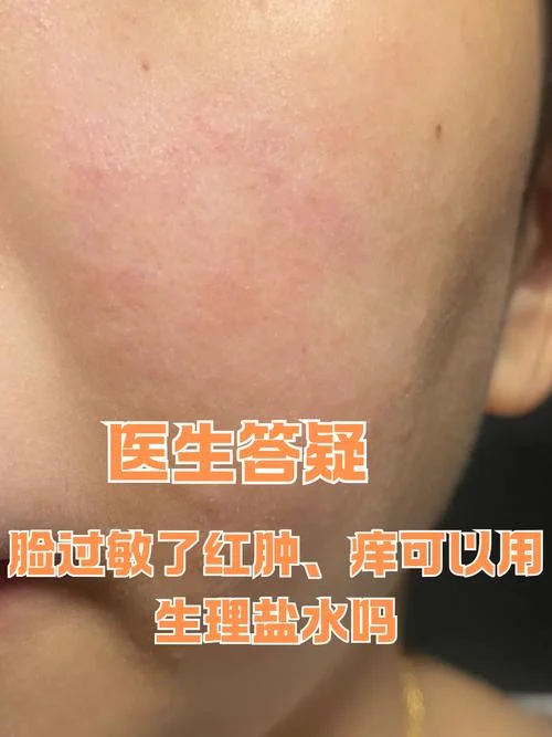 梦见自己的脸烂了过敏_2