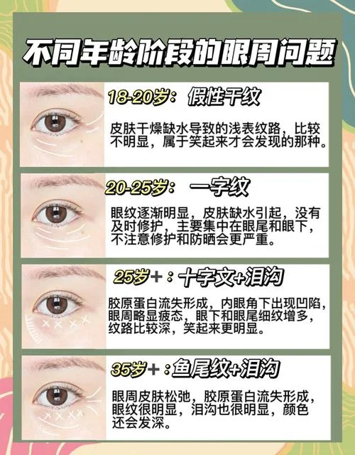 眼周围有皱纹怎么办-消除眼周皱纹