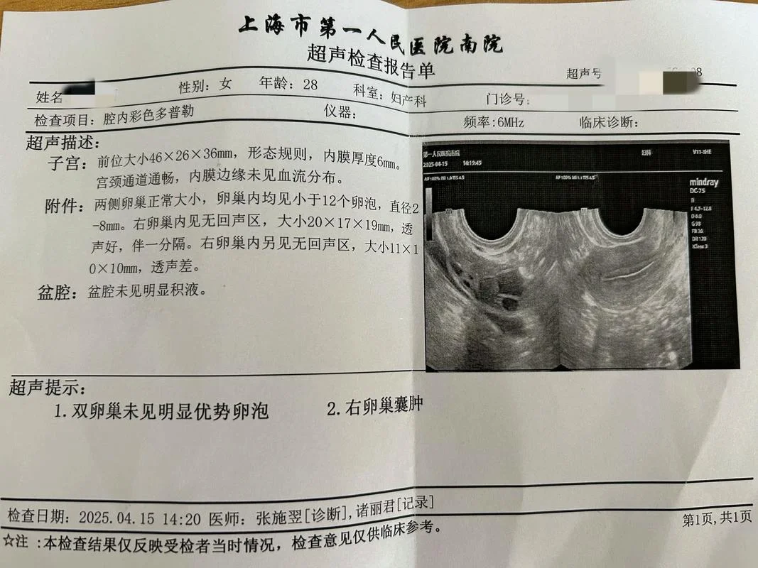 做卵泡监测多少钱一次_2