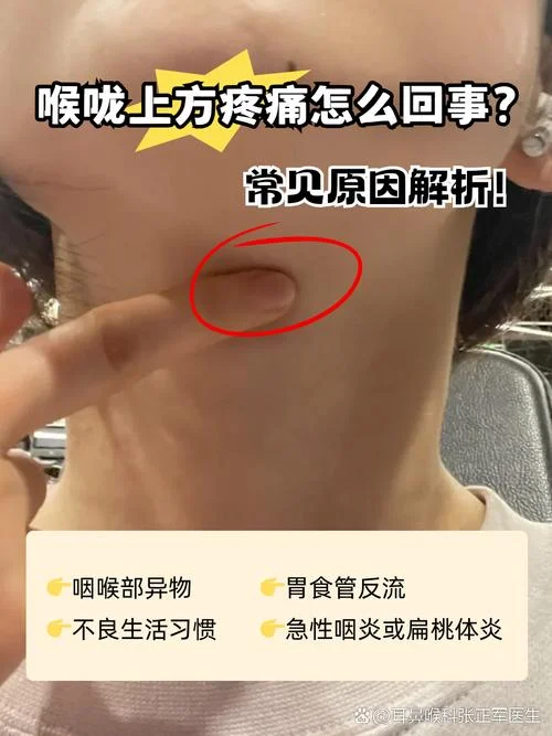 喉咙有异物感是为什么_1