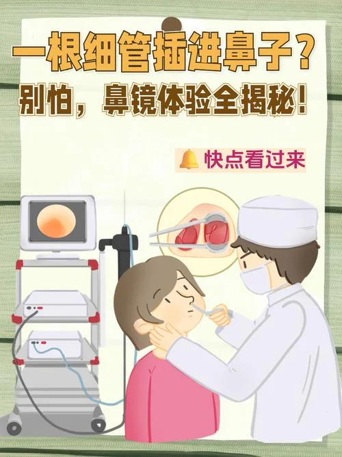 鼻内窥镜多少钱_2