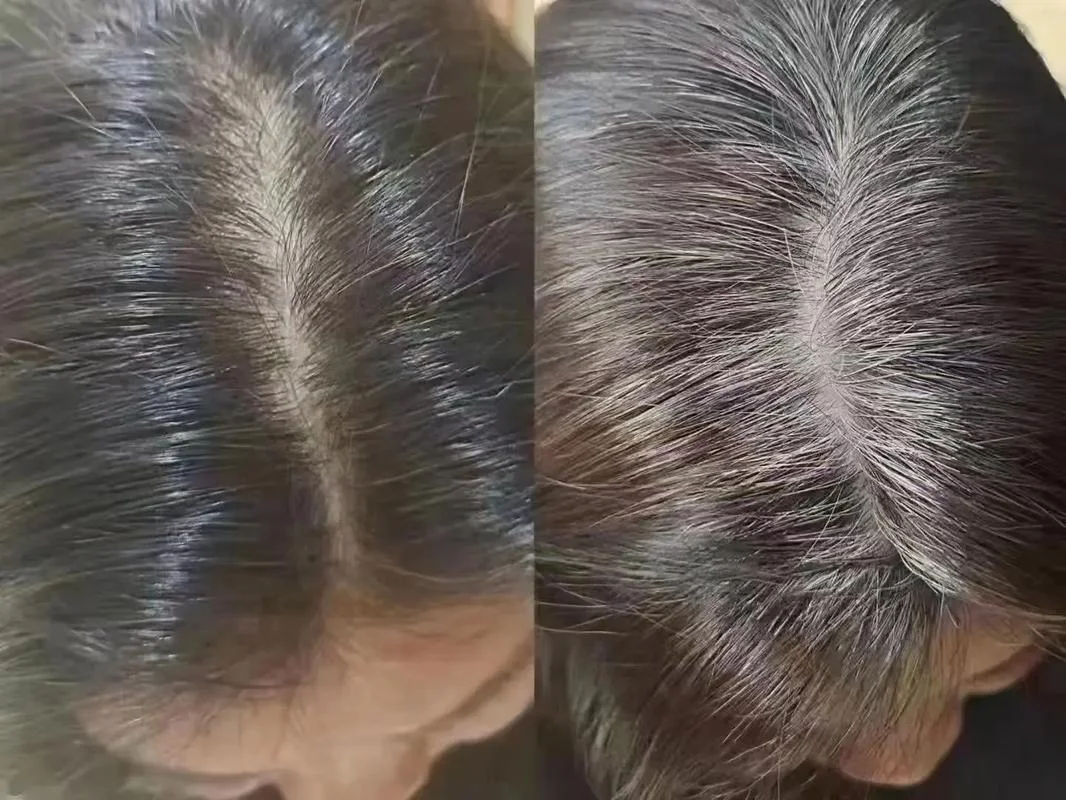 梦到自己白头发变黑了_2
