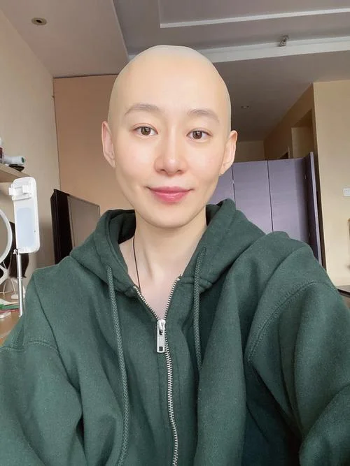 女生做梦梦到自己秃头_1