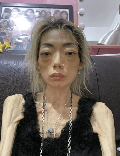 梦见老人瘦如骷髅_2