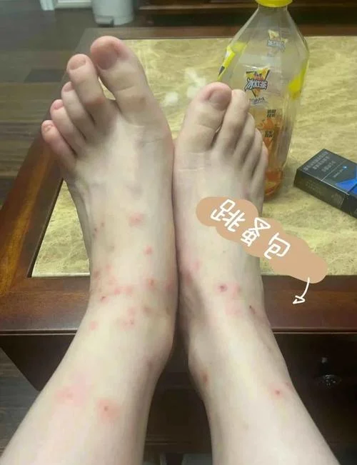 梦到好多跳蚤_1