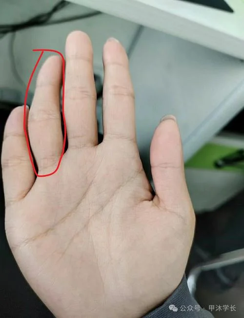 小指无名指合不拢手相-小指无名指合不拢