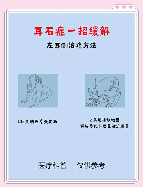 耳石症复位多少钱_2