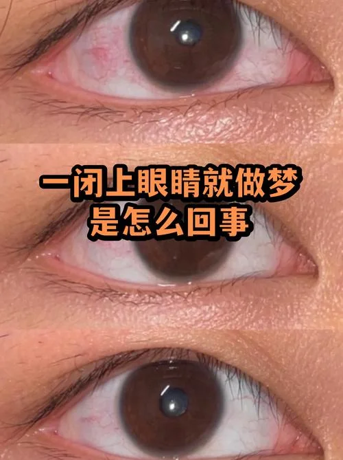 眯眼就做梦是怎么回事_1
