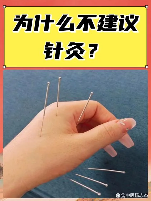 去哪学针灸_2