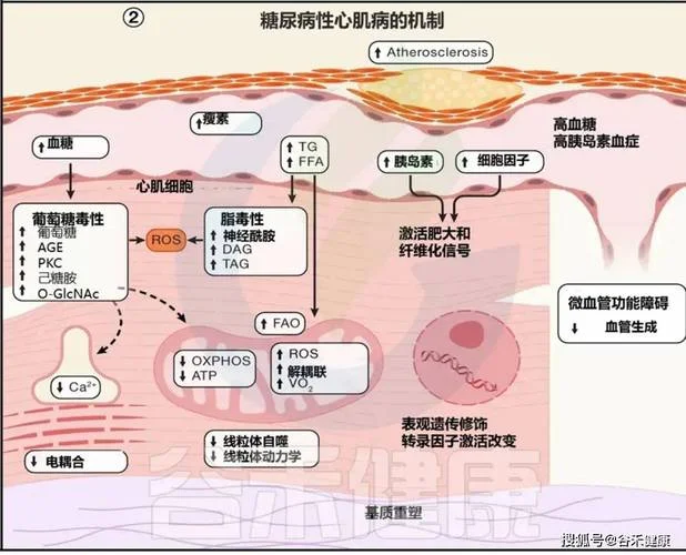 糖尿病的原因和原理-糖尿病成因与原理