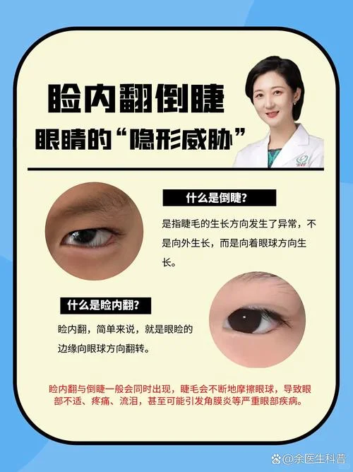 倒睫手术多少钱一平方_2
