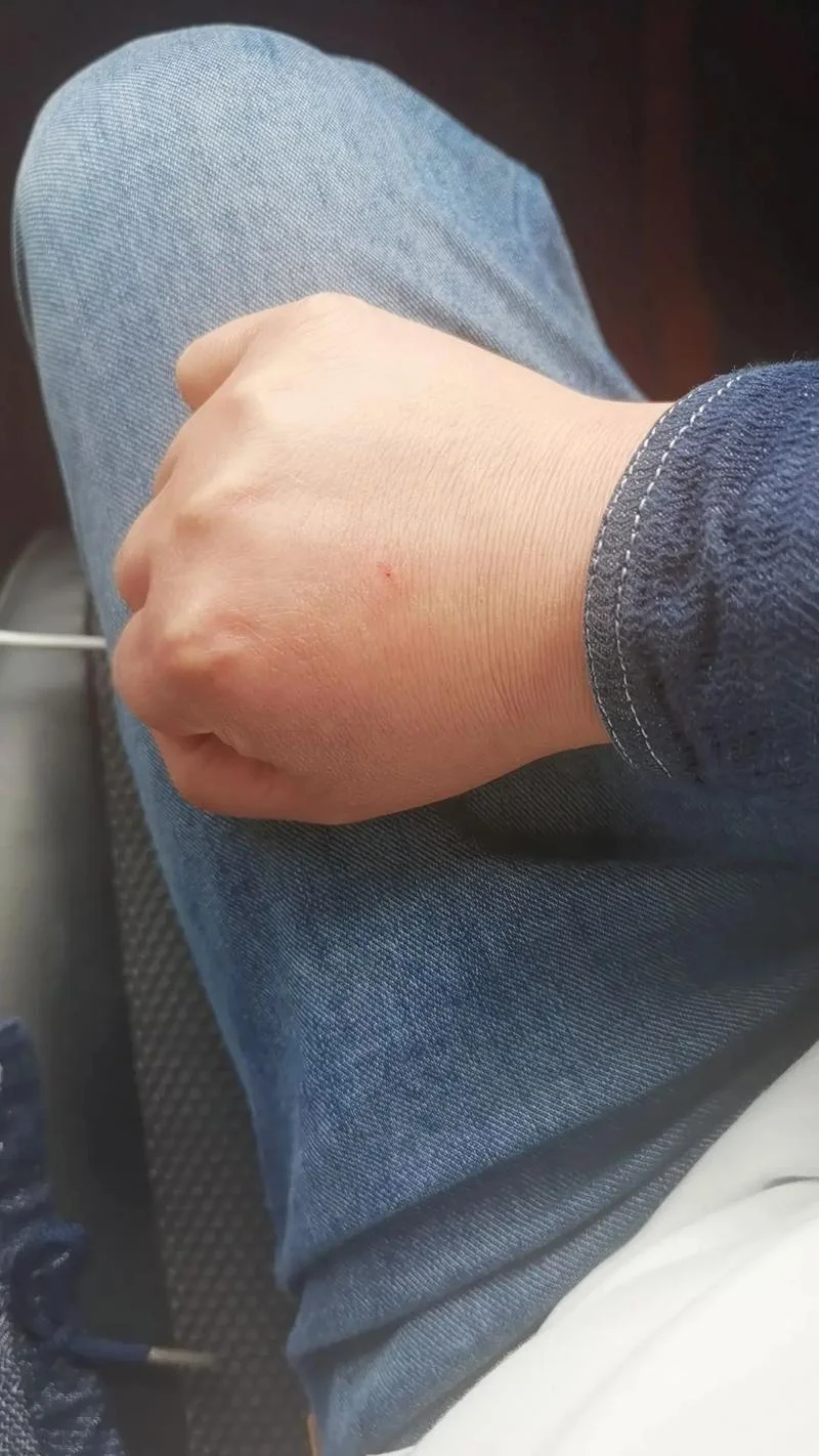 梦见自己手被狗咬出血_1