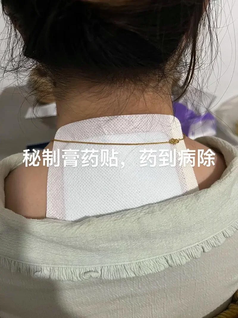 腰椎间盘突出自制膏药_2