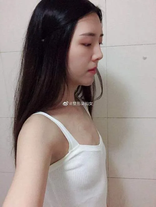 成都丰胸一般多少钱_2
