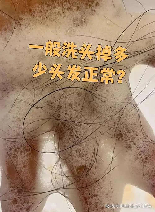 梦见洗头发掉发_1