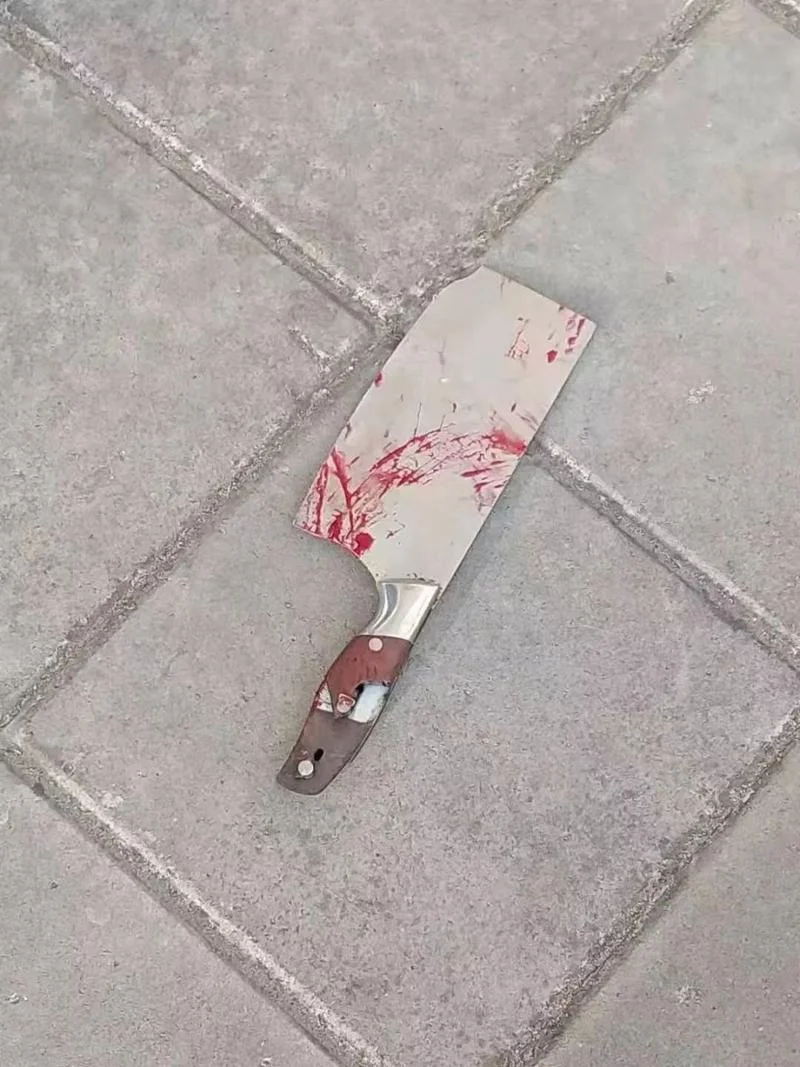 梦到别人头被别人砍了_1