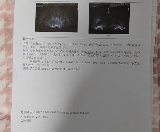 阴超显示回声不均匀什么意思_2