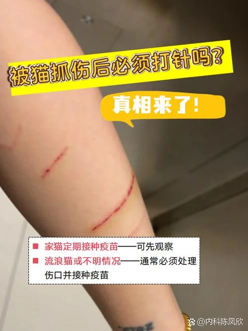 梦见被猫抓伤出血_1