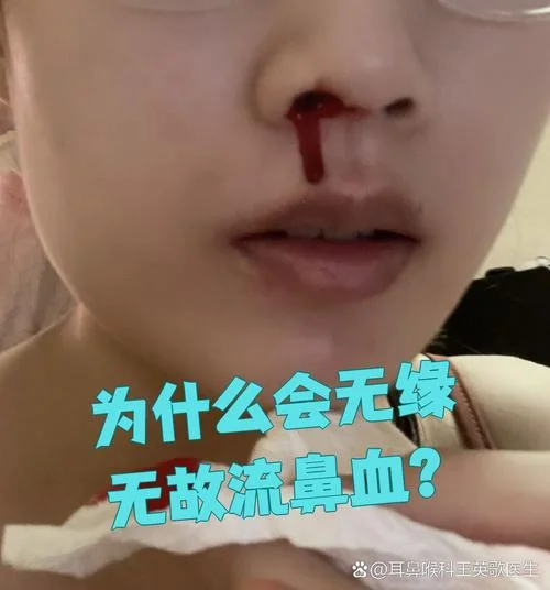 别人梦见流鼻血_1