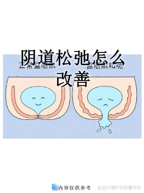 缩阴棒的原理-缩阴棒原理