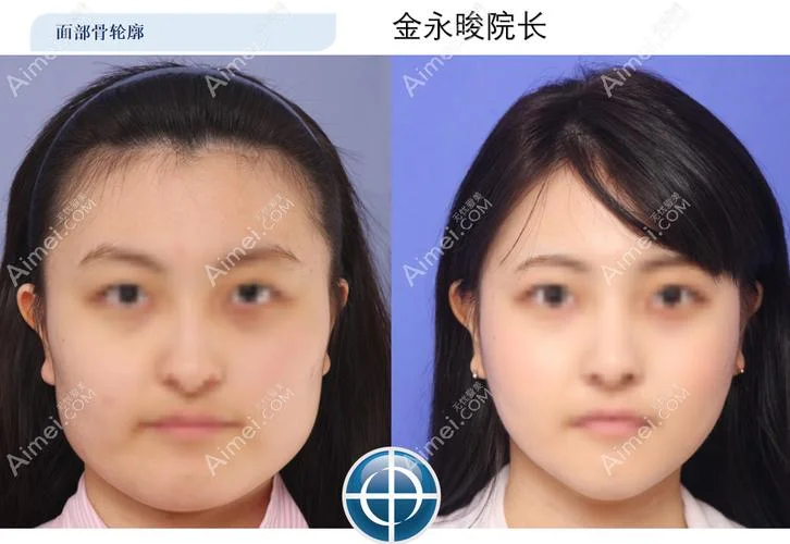 整形去哪个国家-整形去法国