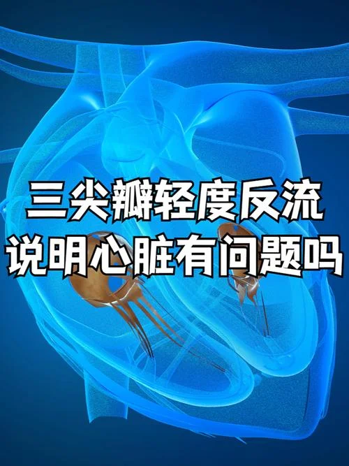 三尖瓣关闭不全是什么意思_2