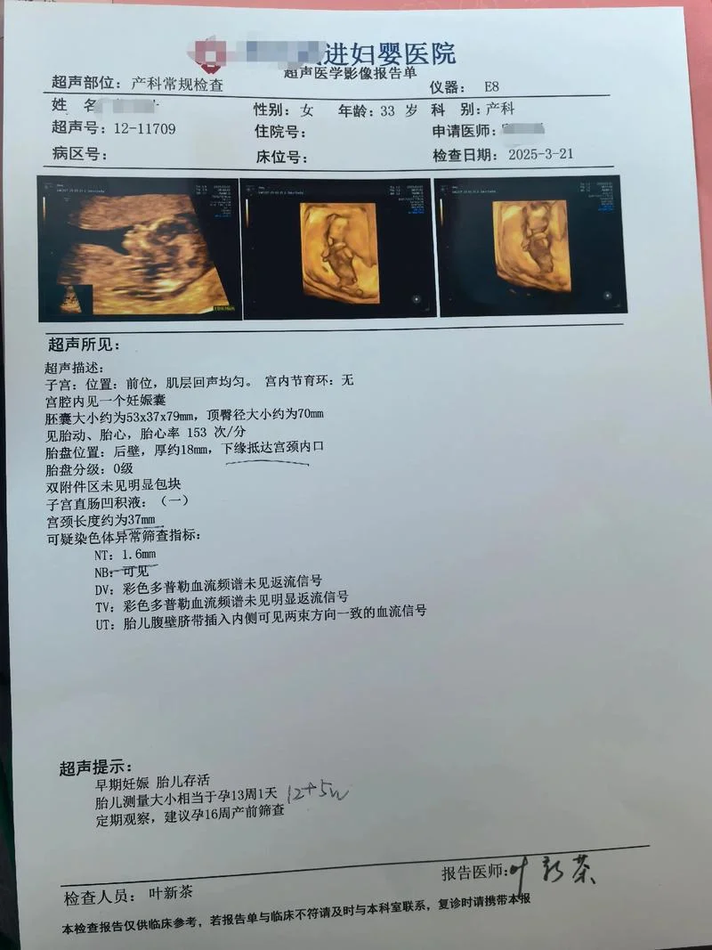 孕检nt是什么检查多少钱_1