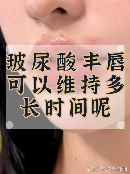 注射玻尿酸丰唇多少钱_1