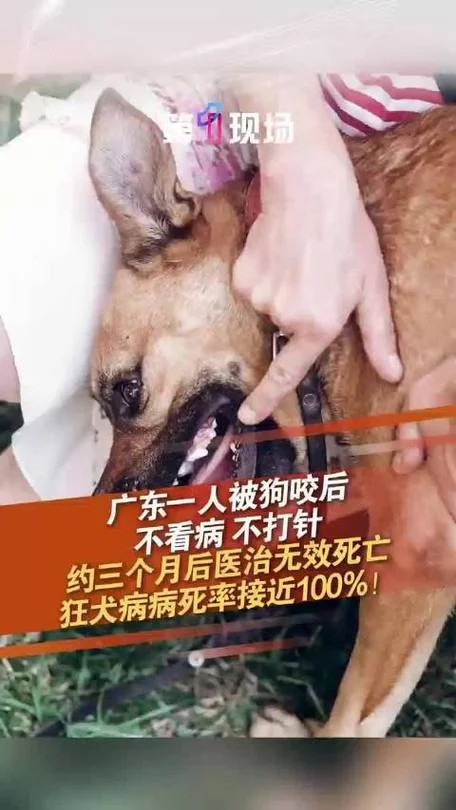 梦见被黑狗咬手没出血_1
