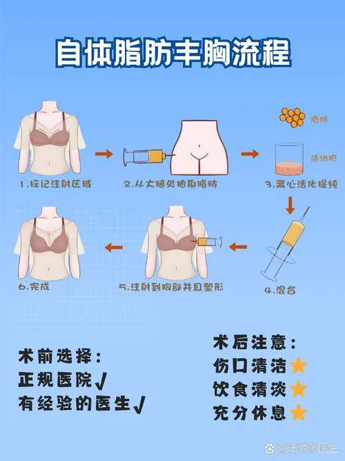 隆胸费用要多少钱呢_2