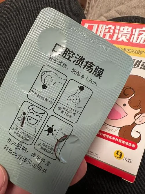 口腔溃疡贴哪个牌子好-口腔溃疡贴选哪个牌子