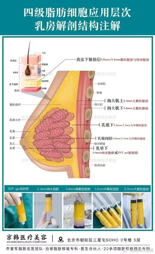 吸脂隆胸的原理_2
