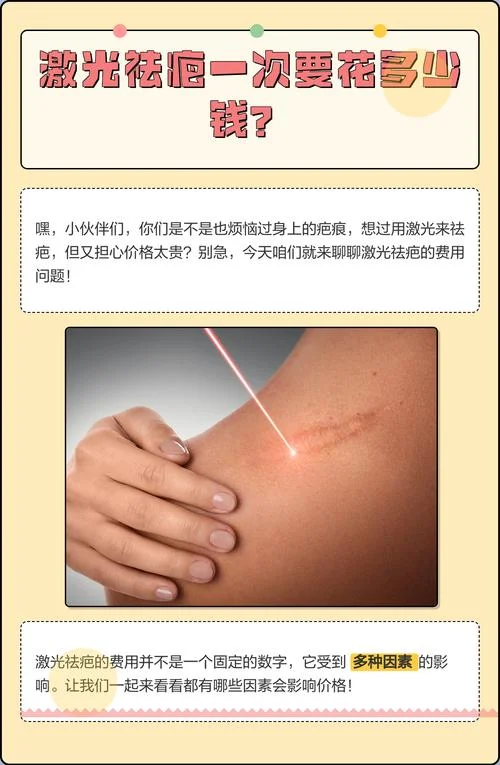 去除疤的医院要多少钱_1