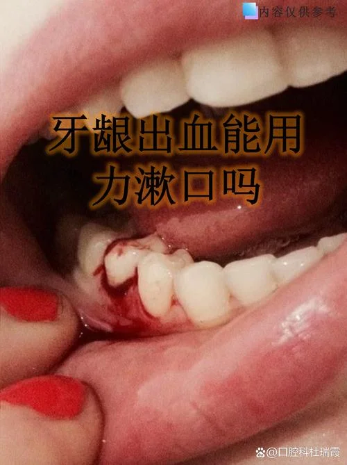 梦见刷牙出血长新牙_1