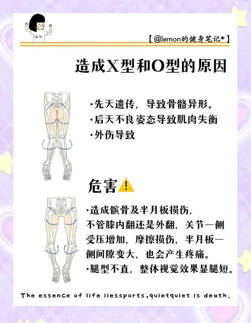 x型腿怎么办教你一招-x 型腿一招教你
