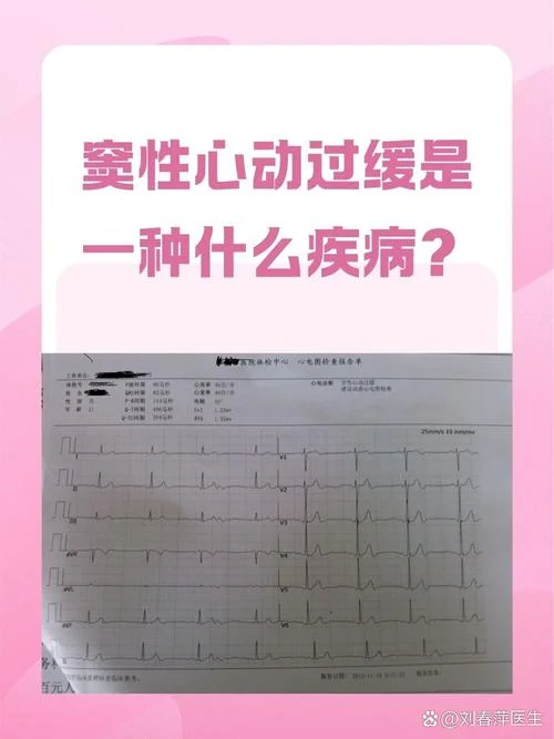 窦性心律不齐什么意思_1