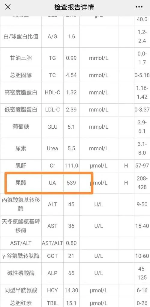 检查血尿酸多少钱_1
