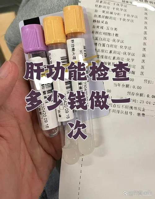 检查肝功能全套多少钱_2