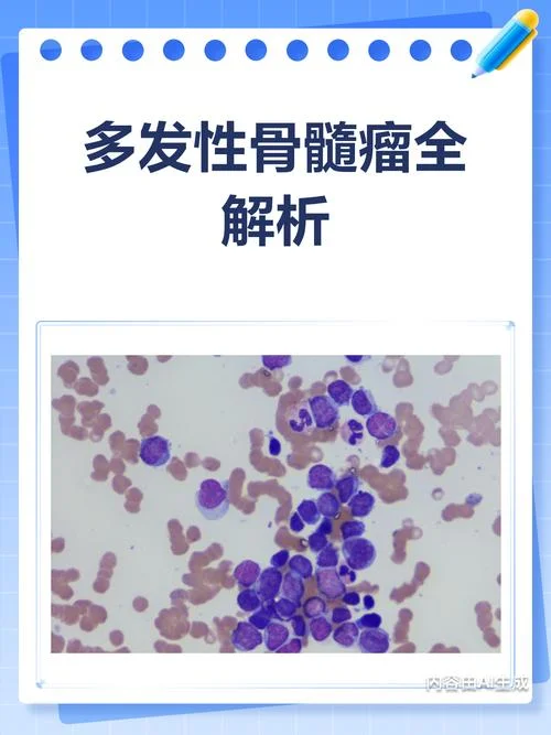 多发骨髓性瘤是什么意思-多发骨髓性瘤含义