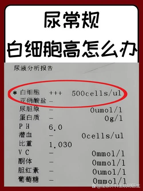 白细胞1+什么意思尿常规_1