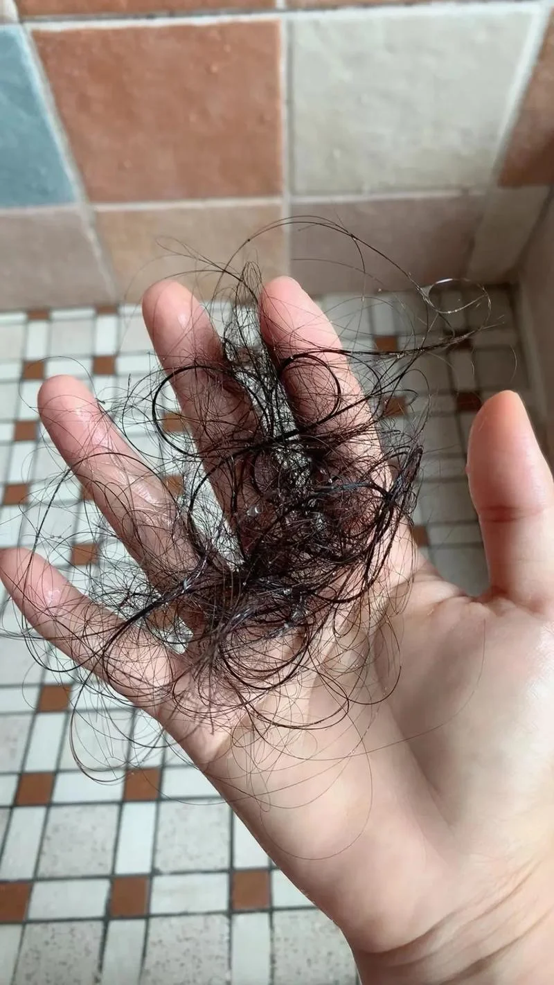 梦见死去的妈妈头发掉了_1