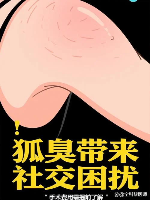 腋臭手术治疗大约多少钱-腋臭手术费用约几百元