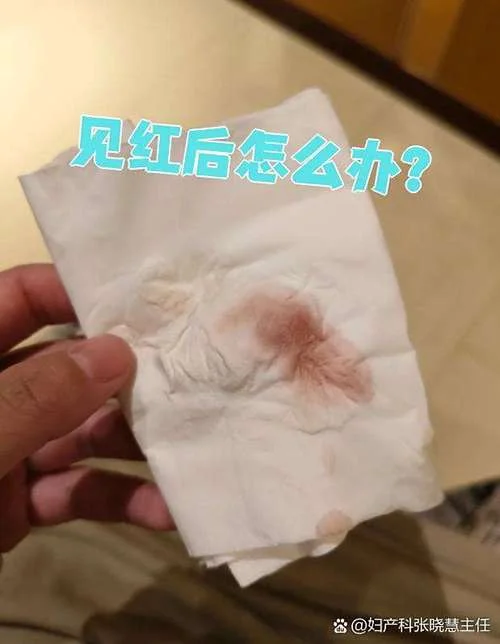 梦见别人生孩子见红_2